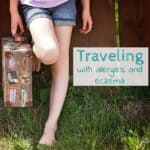 Traveling with Allergies and Eczema